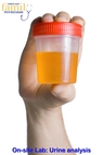 Tampa Bay Family Physicians Lab Urine Analysis